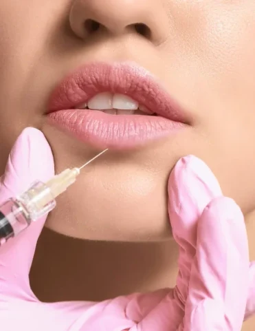 filler labbra