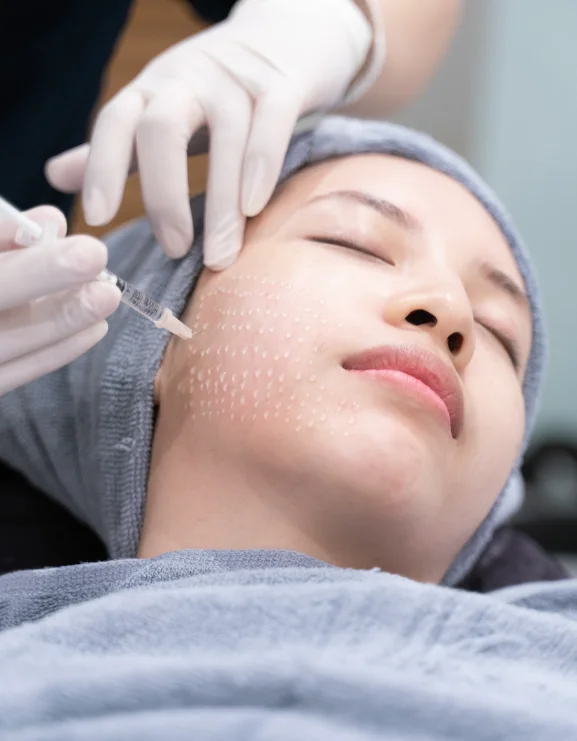 mesoterapia